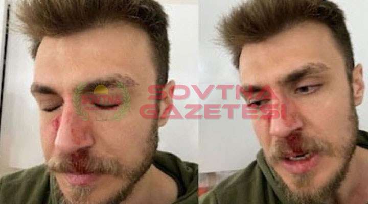 "EŞİMİ ERKEK DOKTOR MUAYENE EDEMEZ" DİYEREK ASİSTAN DOKTORUN BURNUNU KIRDI!