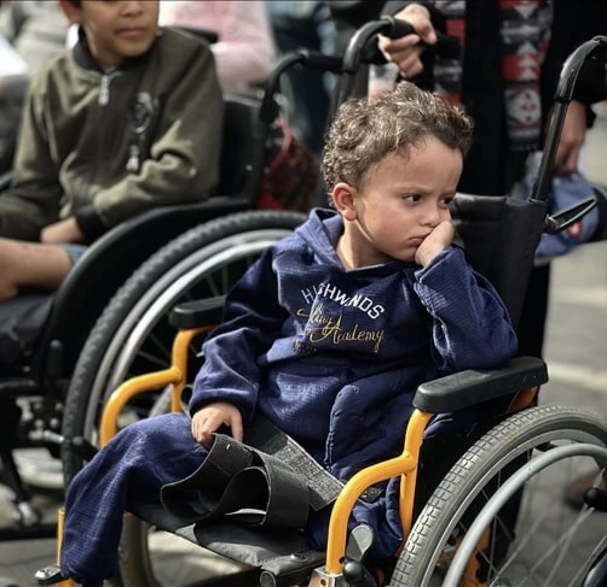 Gazze, D&uuml;nyada N&uuml;fusa Oranla En Fazla Ampute &Ccedil;ocuğun Yaşadığı B&ouml;lge Oldu
