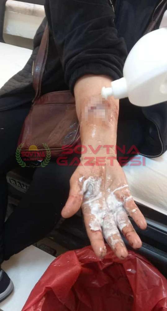 Pitbull cinsi k&ouml;pek kadına saldırdı